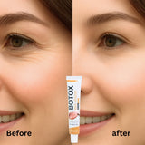 OUHOE - Bee Venom Botox Wrinkle Cream