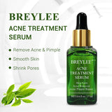 BREYLEE Acne Treatment Serum Face Facial Anti Acne Scar Removal Cream Skin Care Whitening Repair Pimple Remover For Acne