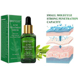 BREYLEE Acne Treatment Serum Face Facial Anti Acne Scar Removal Cream Skin Care Whitening Repair Pimple Remover For Acne