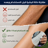 كريم إزالة الشعر بخلاصة زيت جوز الهند النباتي (إزالة الشعر دون ألم)